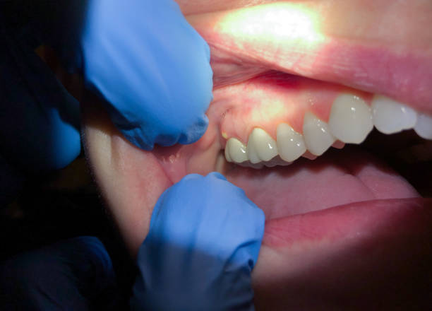 Best Pediatric Emergency Dentist in Glasgow Village, MO
