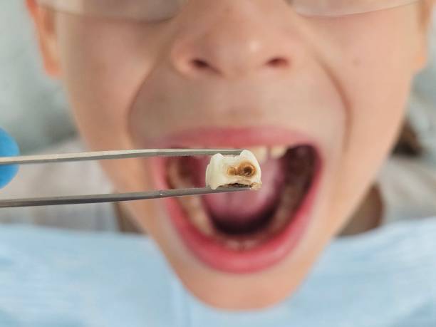 Best Walk-In Emergency Dentist in Glasgow Village, MO